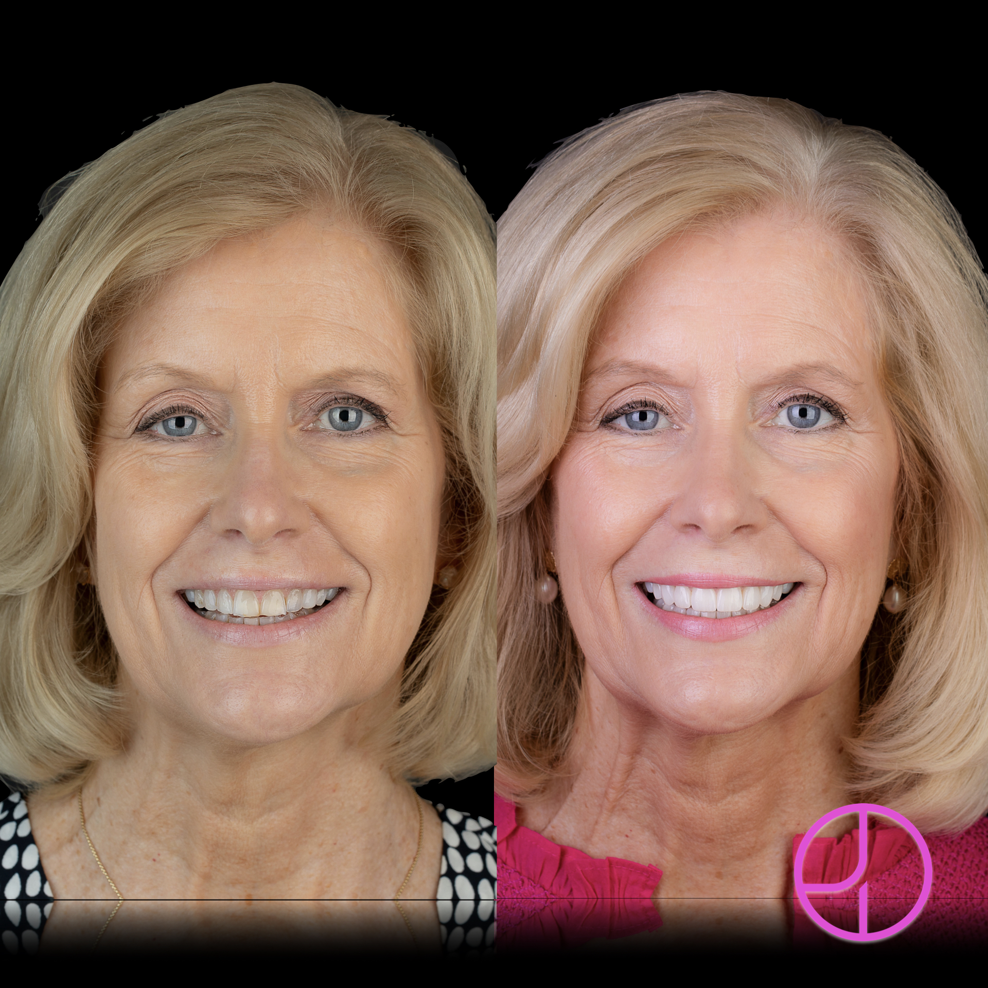 Expertise Dental Smile Gallery