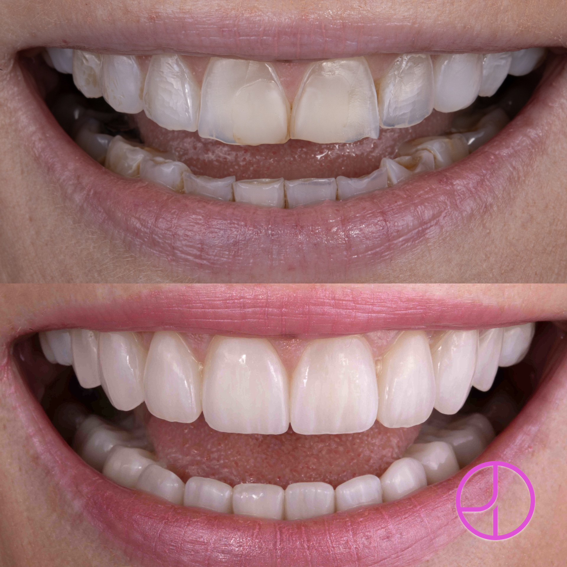 Expertise Dental Smile Gallery