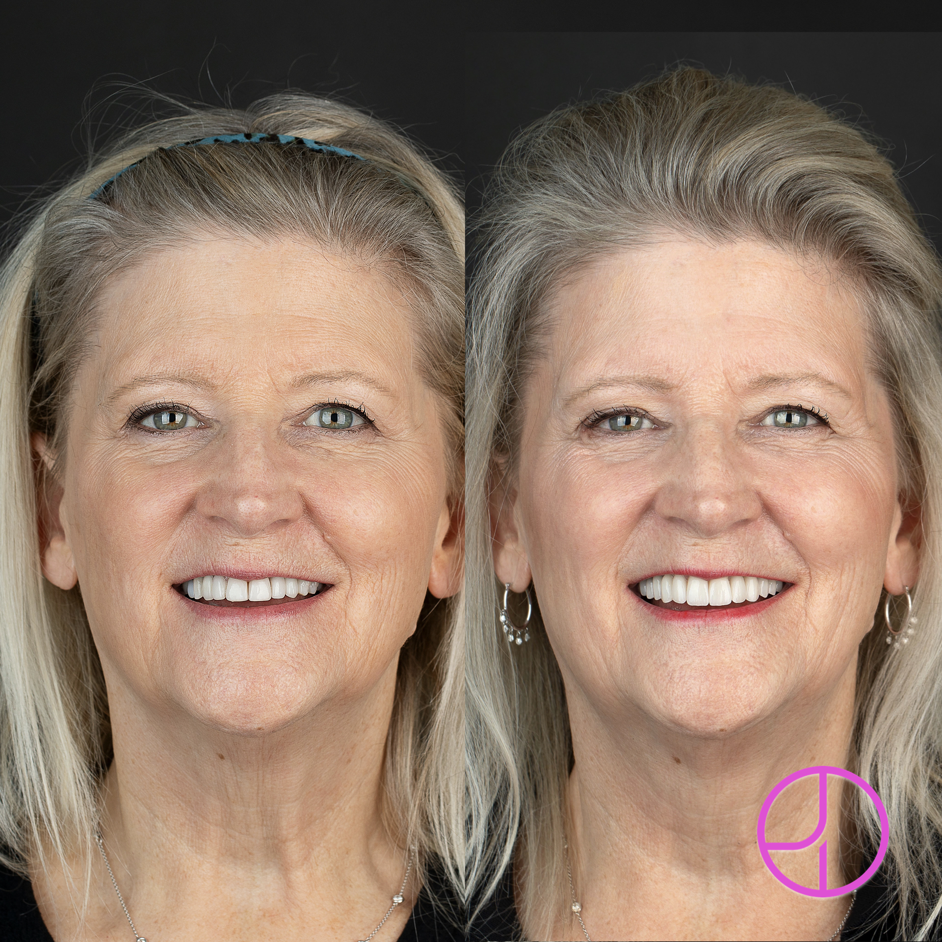 Expertise Dental Smile Gallery