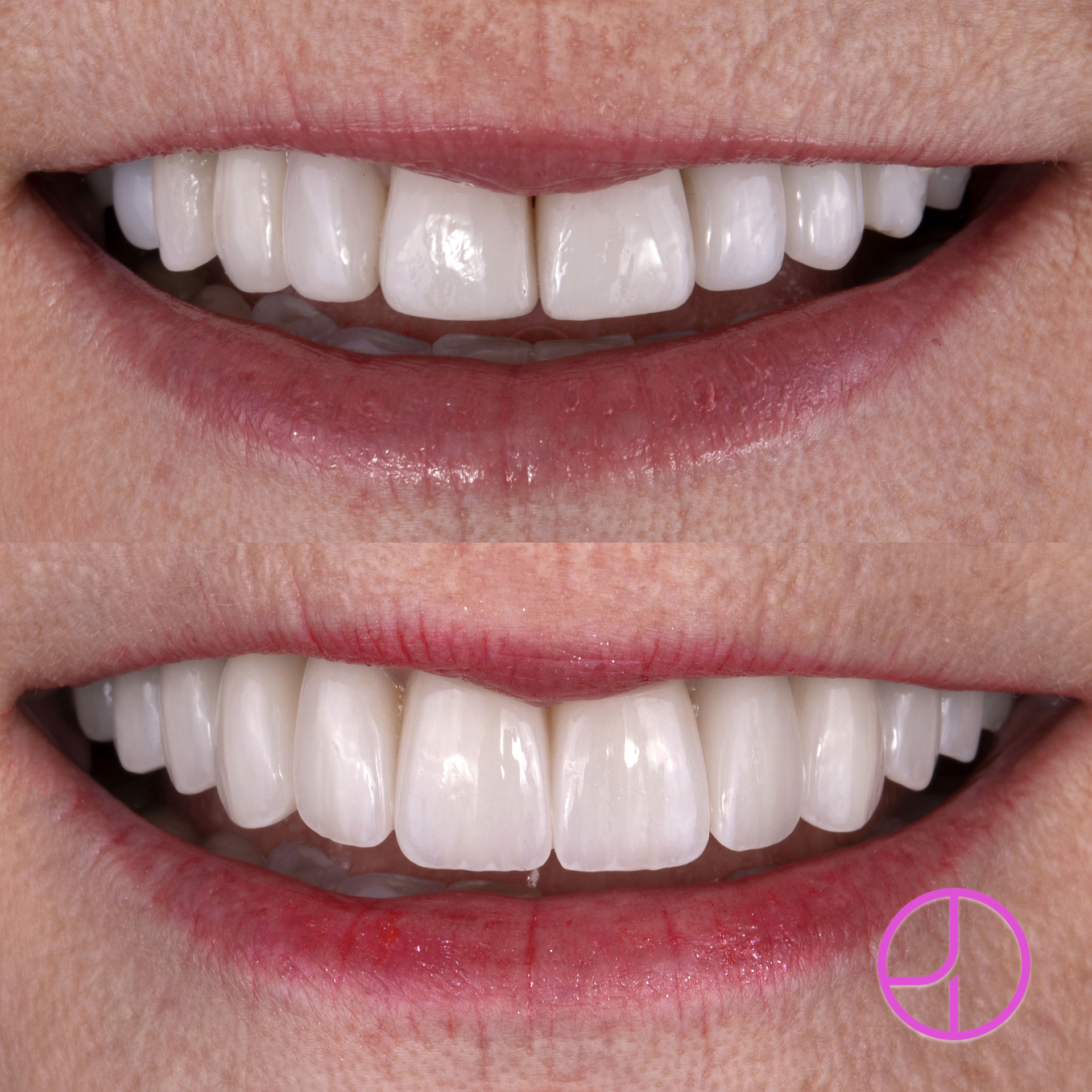 Expertise Dental Smile Gallery