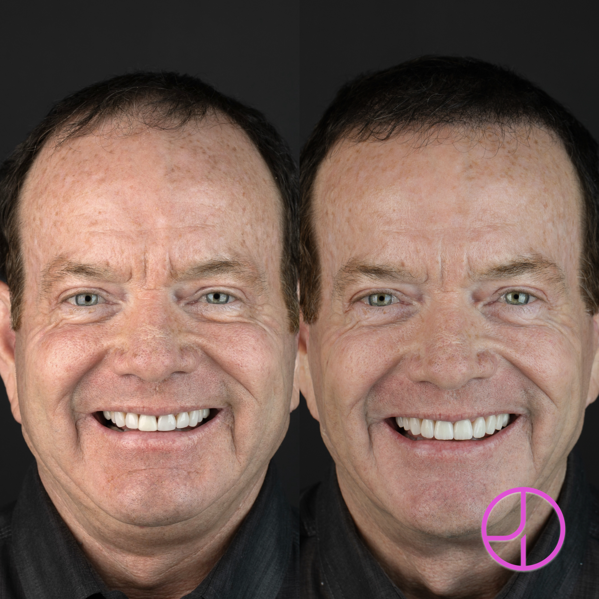Expertise Dental Smile Makeover Dentist in Charleston, SC Smile Makeover Dentist in Charleston, SC