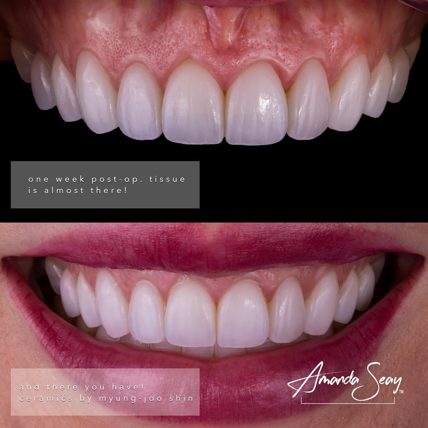 Expertise Dental Conservative Treatment To Improve Function And Aesthetics Expertise case study (2)