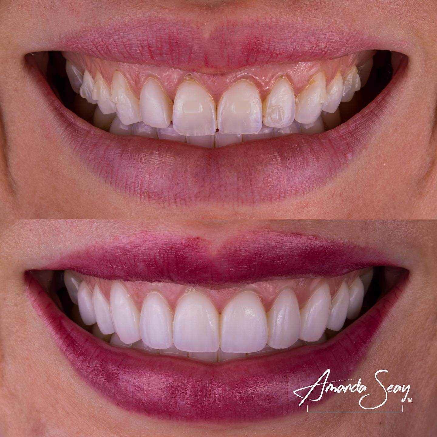 Expertise Dental Conservative Treatment To Improve Function And Aesthetics Expertise case study (2)