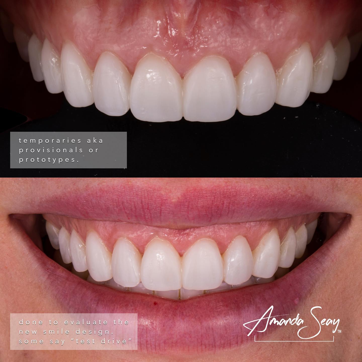 Expertise Dental Conservative Treatment To Improve Function And Aesthetics Expertise case study (2)
