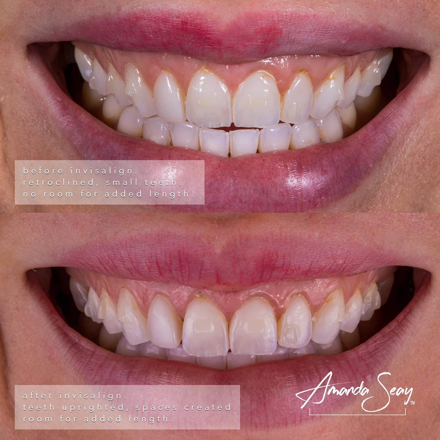 Expertise Dental Conservative Treatment To Improve Function And Aesthetics Expertise Dental Conservative Treatment To Improve Function And Aesthetics