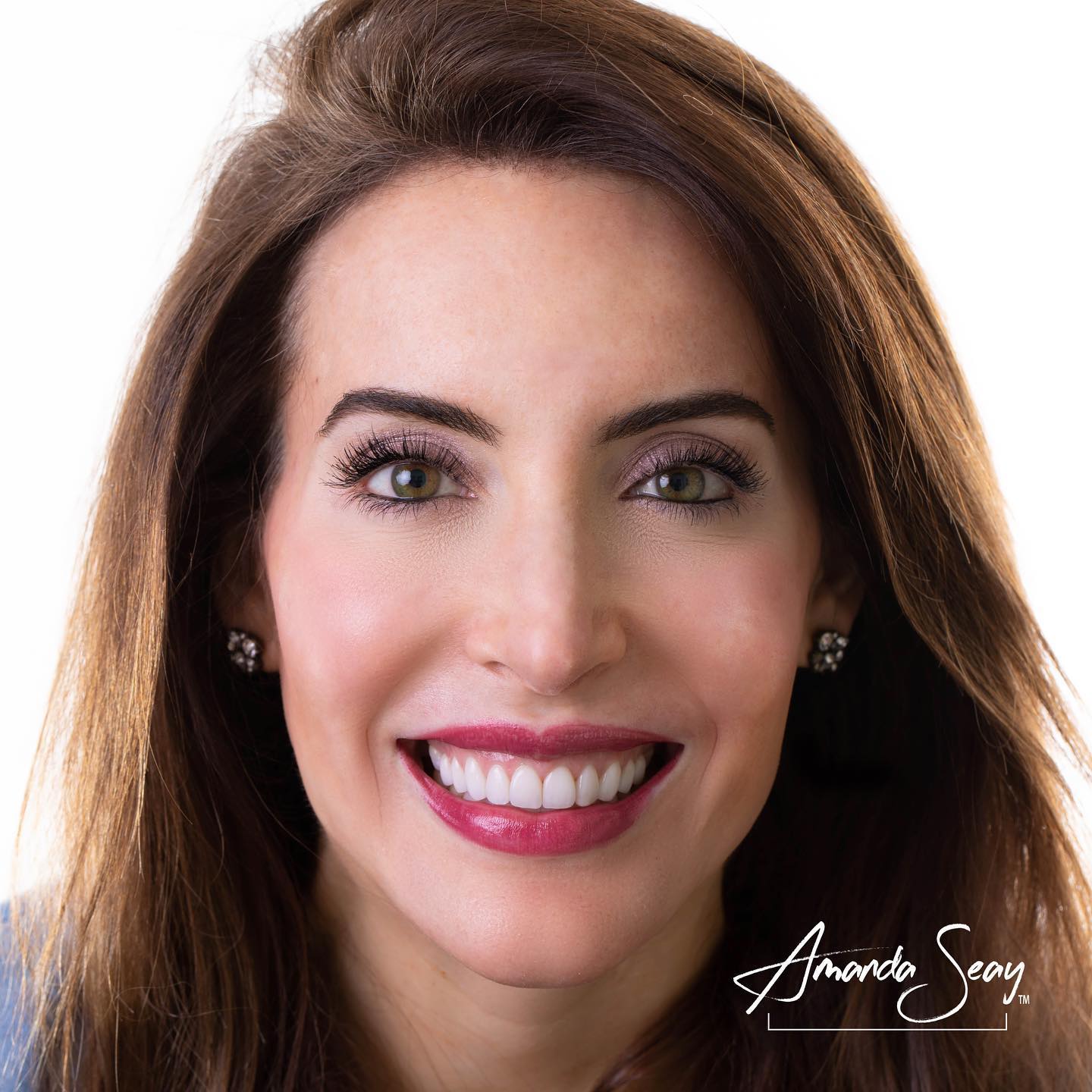 Expertise Dental Conservative Treatment To Improve Function And Aesthetics Expertise case study (2)