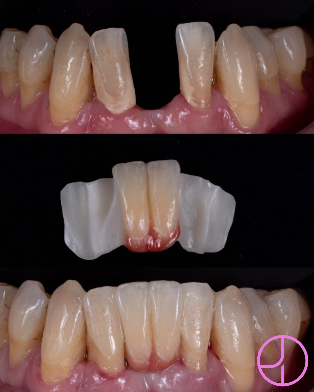 Before and after treatment
