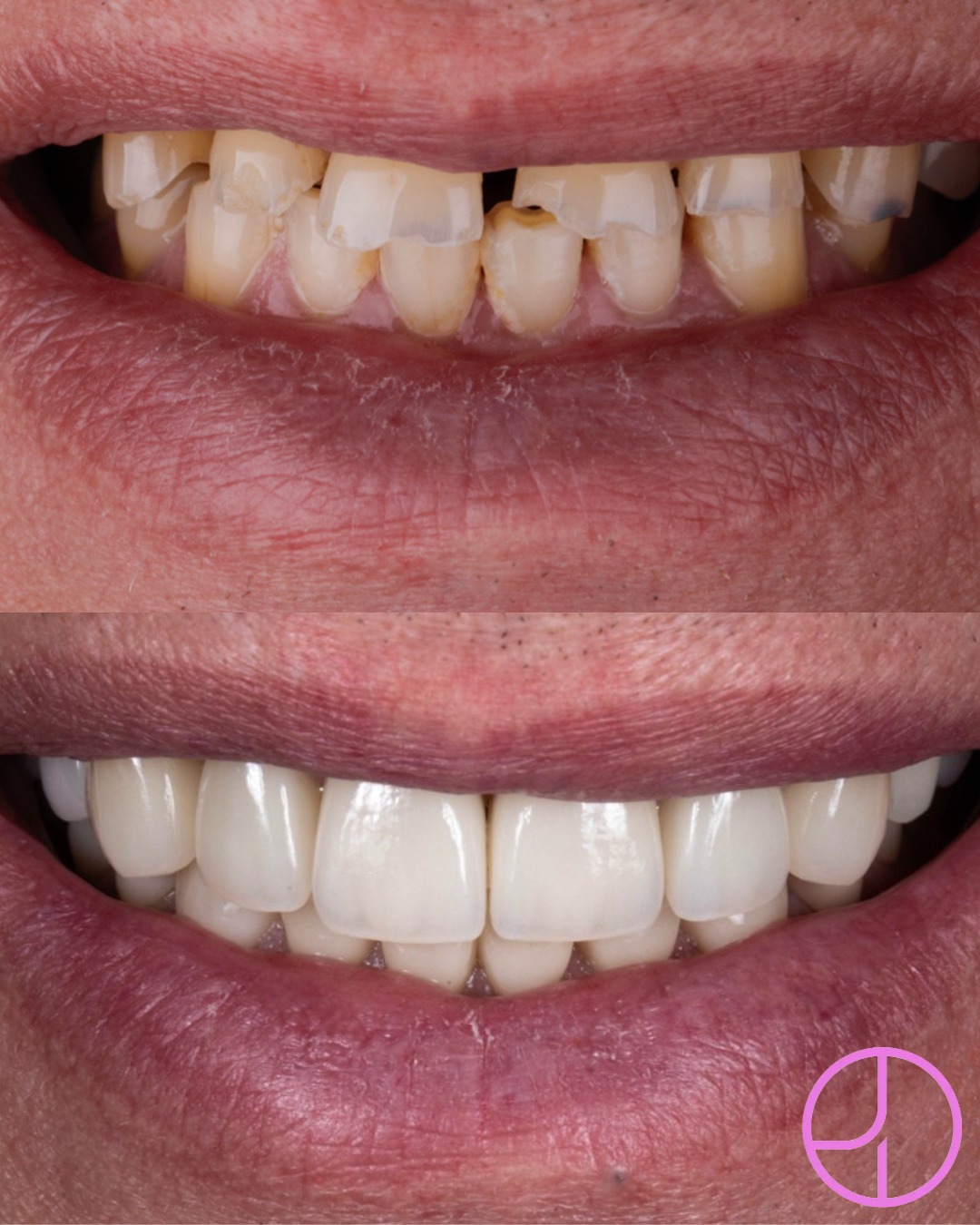 Before and after treatment
