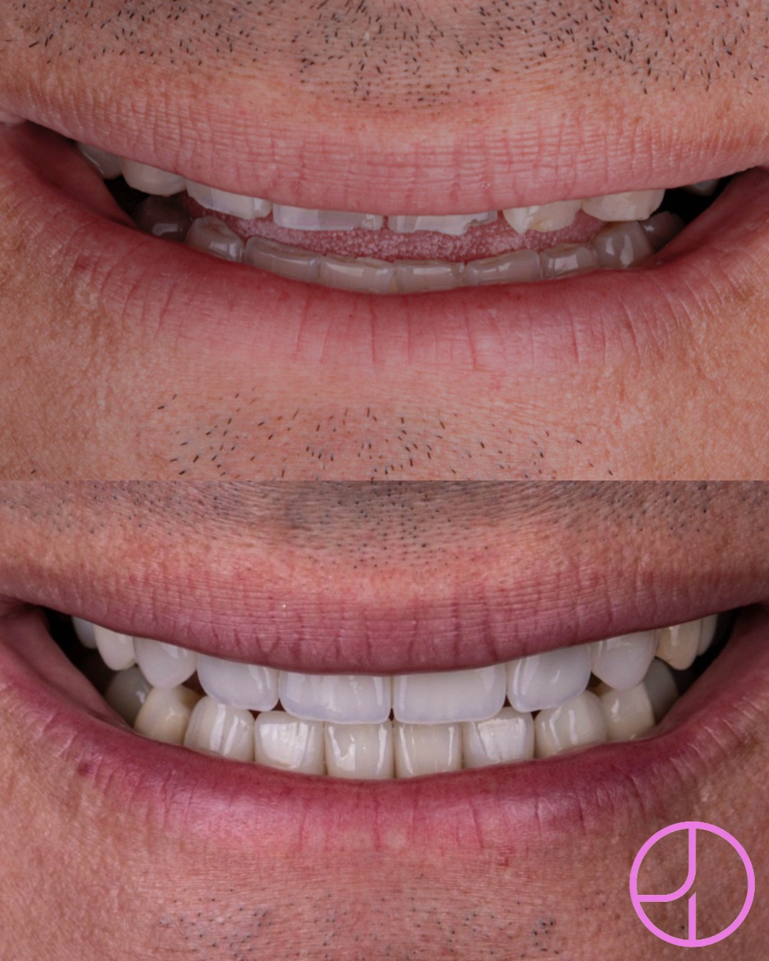Before and after treatment