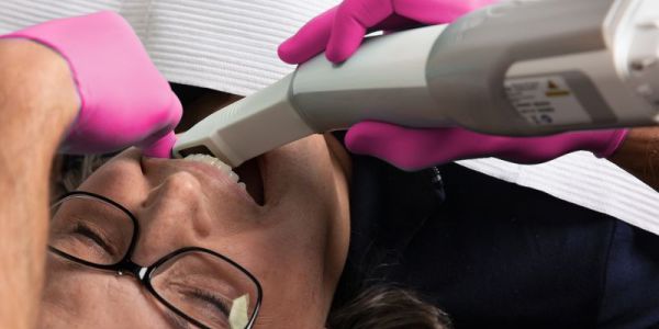 Before and After Dental Treatment at Expertise Dental Charleston